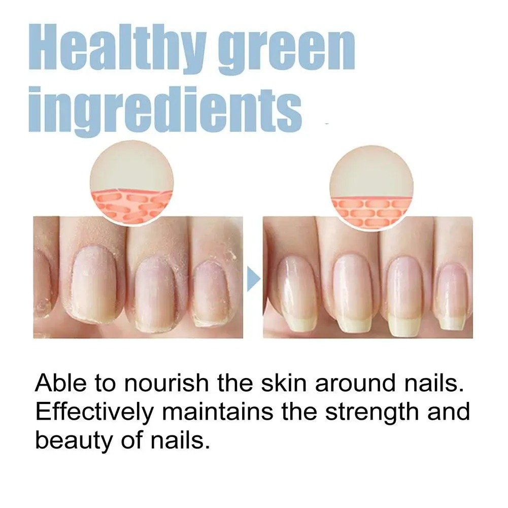 OnyxoGuard Nail Growth and Repair Serum